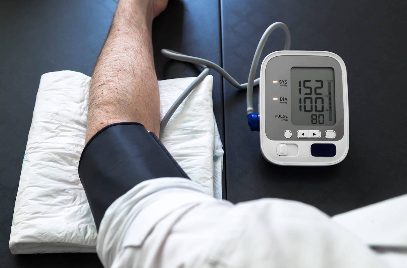 Causes of High Blood Pressure and Prevention
